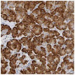 C11orf24, Rabbit, Polyclonal Antibody, Abnova 100 &mu;L | Buy Online | Abnova Corporation | Fisher Scientific