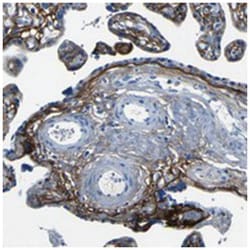 FBN2, Rabbit, Polyclonal Antibody, Abnova 100&mu;L; Unlabeled:Antibodies,