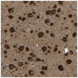 ATP7A, Rabbit, Polyclonal Antibody, Abnova 100&mu;L; Unlabeled:Antibodies,