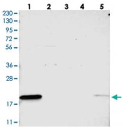 ANKRD22, Rabbit, Polyclonal Antibody, Abnova 100&mu;L; Unlabeled:Antibodies,