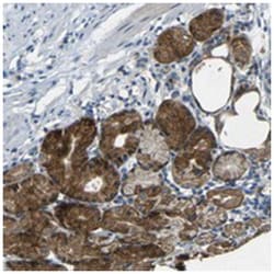 ANKRD22, Rabbit, Polyclonal Antibody, Abnova 100&mu;L; Unlabeled:Antibodies,