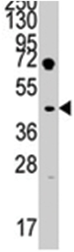 LEFTY1, Rabbit, Polyclonal Antibody, Abnova 400μL; Unlabeled:Antibodies,