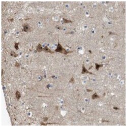 PNMAL1, Rabbit, Polyclonal Antibody, Abnova 100 &mu;L | Buy Online | Abnova Corporation | Fisher Scientific