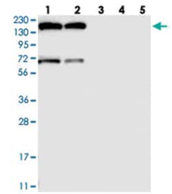 GPR158, Rabbit, Polyclonal Antibody, Abnova 100 &mu;L | Buy Online | Abnova Corporation | Fisher Scientific