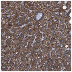 GGT7, Rabbit, Polyclonal Antibody, Abnova 100 &mu;L | Buy Online | Abnova Corporation | Fisher Scientific