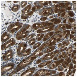 SYDE1, Rabbit, Polyclonal Antibody, Abnova 100 &mu;L | Buy Online | Abnova Corporation | Fisher Scientific