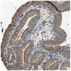 DDX26B, Rabbit, Polyclonal Antibody, Abnova 100 &mu;L | Buy Online | Abnova Corporation | Fisher Scientific