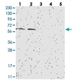 SLC6A1 Rabbit anti-Human, Polyclonal Antibody, Abnova 100&mu;L; Unlabeled:Antibodies,