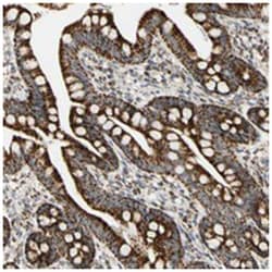 SLC6A1 Rabbit anti-Human, Polyclonal Antibody, Abnova 100&mu;L; Unlabeled:Antibodies,