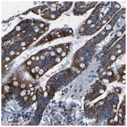 WSCD2, Rabbit, Polyclonal Antibody, Abnova 100 &mu;L | Buy Online | Abnova | Fisher Scientific