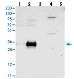 RELL1, Rabbit, Polyclonal Antibody, Abnova 100 &mu;L | Buy Online | Abnova Corporation | Fisher Scientific