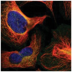 RELL1, Rabbit, Polyclonal Antibody, Abnova 100 &mu;L | Buy Online | Abnova Corporation | Fisher Scientific