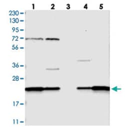 SPCS2, Rabbit, Polyclonal Antibody, Abnova 100 &mu;L | Buy Online | Abnova Corporation | Fisher Scientific