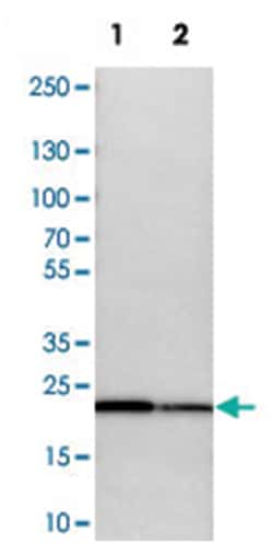 SPCS2, Rabbit, Polyclonal Antibody, Abnova 100 &mu;L | Buy Online | Abnova Corporation | Fisher Scientific