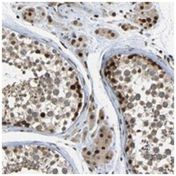 SPCS2, Rabbit, Polyclonal Antibody, Abnova 100 &mu;L | Buy Online | Abnova Corporation | Fisher Scientific