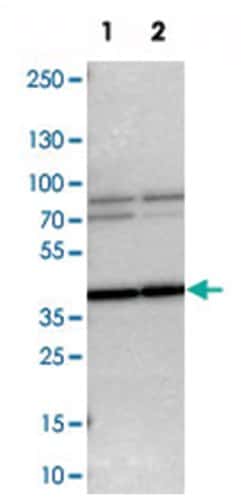 WBSCR17, Rabbit, Polyclonal Antibody, Abnova 100&mu;L; Unlabeled:Antibodies,