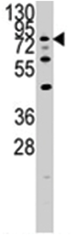 DYRK1A Rabbit anti-Human, Polyclonal Antibody, Abnova 400 &mu;L | Buy Online | Abnova Corporation | Fisher Scientific