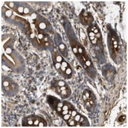 GABBR2 Rabbit anti-Human, Polyclonal Antibody, Abnova 100 &mu;L | Buy Online | Abnova Corporation | Fisher Scientific