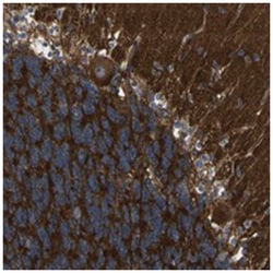 LRTM1, Rabbit, Polyclonal Antibody, Abnova 100 &mu;L | Buy Online | Abnova Corporation | Fisher Scientific