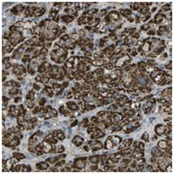 KLHL5, Rabbit, Polyclonal Antibody, Abnova 100 &mu;L | Buy Online | Abnova Corporation | Fisher Scientific
