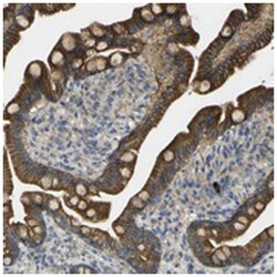 RHBDD1 Rabbit anti-Human, Polyclonal Antibody, Abnova 100 &mu;L | Buy Online | Abnova Corporation | Fisher Scientific