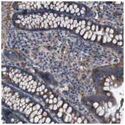 SLC6A9, Rabbit, Polyclonal Antibody, Abnova 100&mu;L; Unlabeled:Antibodies,