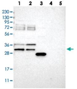 RBM7, Rabbit, Polyclonal Antibody, Abnova 100 &mu;L | Buy Online | Abnova Corporation | Fisher Scientific