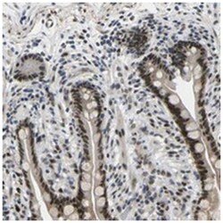 RBM7, Rabbit, Polyclonal Antibody, Abnova 100 &mu;L | Buy Online | Abnova Corporation | Fisher Scientific