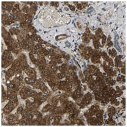 FUT11, Rabbit, Polyclonal Antibody, Abnova 100&mu;L; Unlabeled:Antibodies,