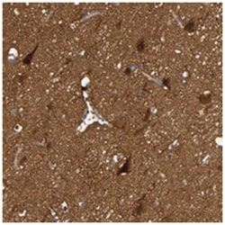 DPCR1, Rabbit, Polyclonal Antibody, Abnova 100 &mu;L | Buy Online | Abnova Corporation | Fisher Scientific