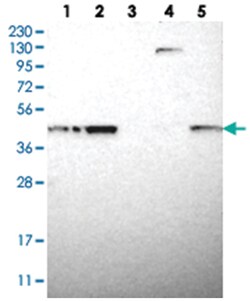 TMED2, Rabbit, Polyclonal Antibody, Abnova 100&mu;L; Unlabeled:Antibodies,