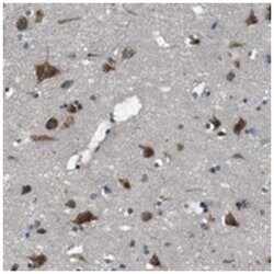 TMED2, Rabbit, Polyclonal Antibody, Abnova 100&mu;L; Unlabeled:Antibodies,