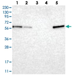 TXNDC10, Rabbit, Polyclonal Antibody, Abnova 100 &mu;L | Buy Online | Abnova Corporation | Fisher Scientific
