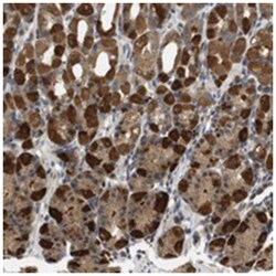 TXNDC10, Rabbit, Polyclonal Antibody, Abnova 100 &mu;L | Buy Online | Abnova Corporation | Fisher Scientific