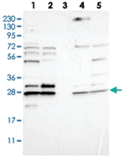 CNPY4 Rabbit anti-Human, Polyclonal Antibody, Abnova 100 &mu;L | Buy Online | Abnova | Fisher Scientific