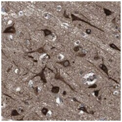 KIAA1715, Rabbit, Polyclonal Antibody, Abnova 100 &mu;L | Buy Online | Abnova Corporation | Fisher Scientific