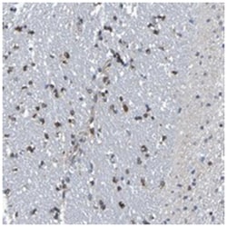 TMCC3, Rabbit, Polyclonal Antibody, Abnova 100&mu;L; Unlabeled:Antibodies,