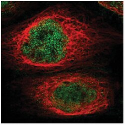 KCTD10, Rabbit, Polyclonal Antibody, Abnova 100&mu;L; Unlabeled:Antibodies,
