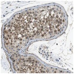 ENTPD7, Rabbit, Polyclonal Antibody, Abnova 100&mu;L; Unlabeled:Antibodies,