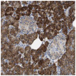 SDR42E1, Rabbit, Polyclonal Antibody, Abnova 100 &mu;L | Buy Online | Abnova Corporation | Fisher Scientific