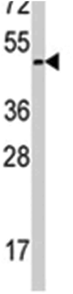 E2F1 Rabbit anti-Human, Polyclonal Antibody, Abnova 400 &mu;L | Buy Online | Abnova Corporation | Fisher Scientific