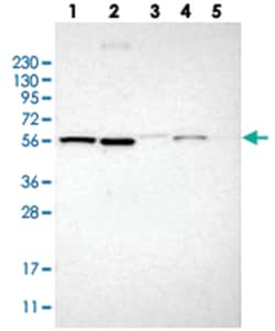 TMEM194A, Rabbit, Polyclonal Antibody, Abnova 100&mu;L; Unlabeled:Antibodies,