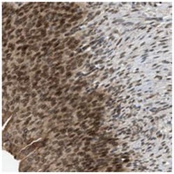 TMEM194A, Rabbit, Polyclonal Antibody, Abnova 100&mu;L; Unlabeled:Antibodies,