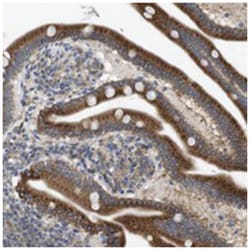 PCNXL2 Rabbit anti-Human, Polyclonal Antibody, Abnova 100 &mu;L | Buy Online | Abnova Corporation | Fisher Scientific