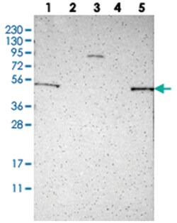 KIAA0513 Rabbit anti-Human, Polyclonal Antibody, Abnova 100 &mu;L | Buy Online | Abnova Corporation | Fisher Scientific