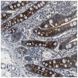 LOC116236, Rabbit, Polyclonal Antibody, Abnova 100 &mu;L | Buy Online | Abnova Corporation | Fisher Scientific