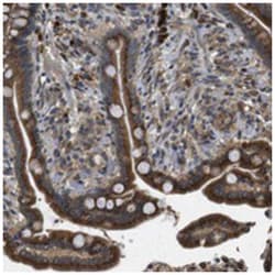 TMEM143, Rabbit, Polyclonal Antibody, Abnova 100 &mu;L | Buy Online | Abnova Corporation | Fisher Scientific