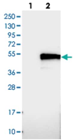 TMEM143, Rabbit, Polyclonal Antibody, Abnova 100 &mu;L | Buy Online | Abnova Corporation | Fisher Scientific