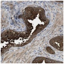 CLRN3, Rabbit, Polyclonal Antibody, Abnova 100 &mu;L | Buy Online | Abnova Corporation | Fisher Scientific