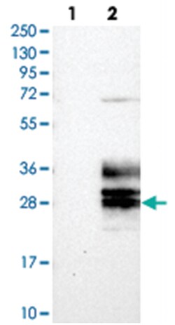 CLRN3, Rabbit, Polyclonal Antibody, Abnova 100 &mu;L | Buy Online | Abnova Corporation | Fisher Scientific